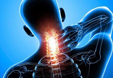 intenzívna bolesť krku s pokročilou osteochondrózou