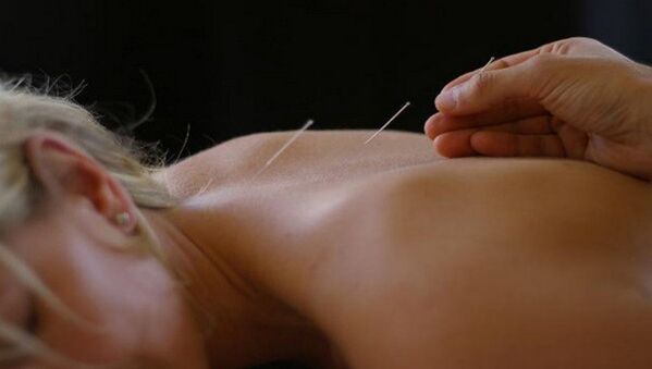akupunktúra pri bolestiach chrbta
