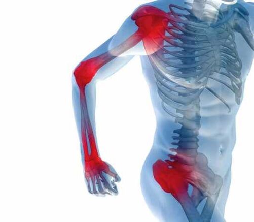 Artralgia - bolesť kĺbov