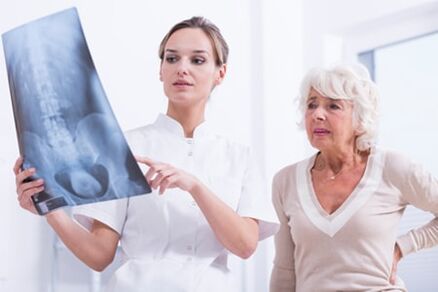 Röntgenové vyšetrenie je informatívny spôsob diagnostiky osteochondrózy chrbtice