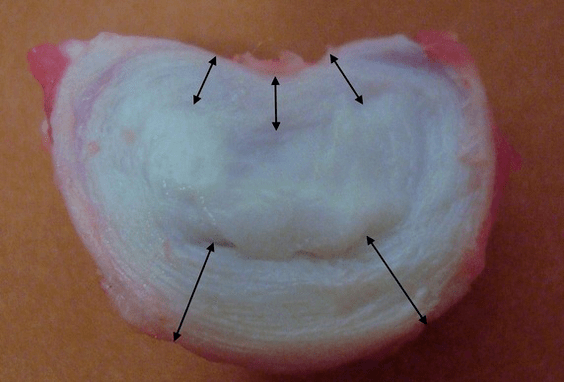 ako vyzerá medzistavcová platnička